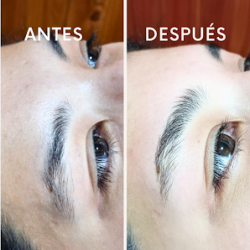 Negocio Depilación.ser