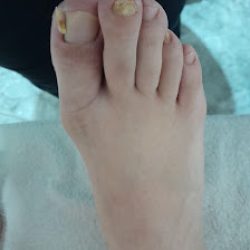 Negocio Pedicura B&m